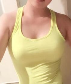 隆胸兩周了