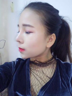 廣州廣美做的假體隆鼻，給大家分享一下手術(shù)前后過程以及對(duì)比照片