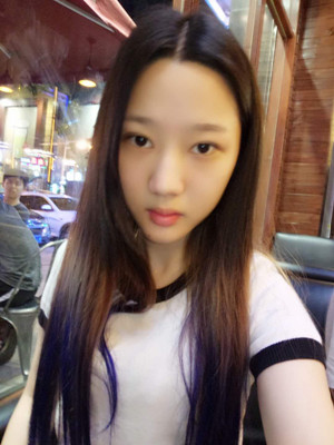 切開雙眼皮+假體隆下巴，我不再是典型的路人甲