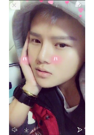 玻尿酸隆鼻+墊下巴親身經(jīng)歷~~果不錯哦