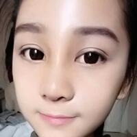 隆鼻整形恢復(fù)日記分享，整形價(jià)格8800元