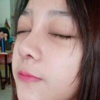 隆鼻整形恢復(fù)日記分享，整形價(jià)格8800元