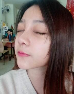 隆鼻整形恢復(fù)日記分享