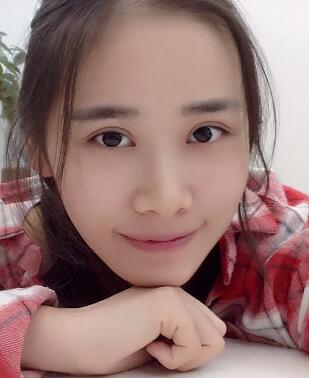 割雙眼皮一個(gè)半月了，雙眼皮完全恢復(fù)自然