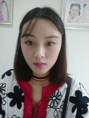 自體脂肪填充全臉，我也可以美美噠