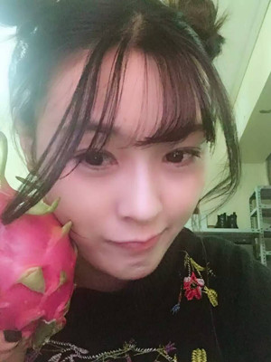 自體脂肪填充全臉，我也可以美美噠