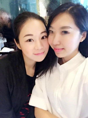 做完高強(qiáng)度聚焦超聲之后都說我變漂亮了