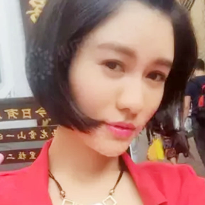 玻尿酸注射鼻子+下巴+太陽穴+蘋果肌術(shù)后一個月的果照片~