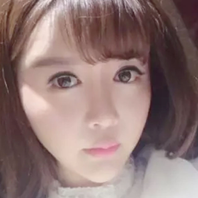 玻尿酸注射隆鼻、自體脂肪豐太陽(yáng)穴跟玻尿酸墊下巴兩個(gè)月果照片~