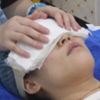 去眼袋手術多少錢？做了激光去眼袋價格5800元，恢復很好