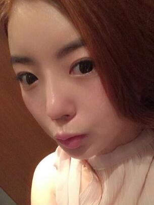 下頜骨整形一個(gè)月