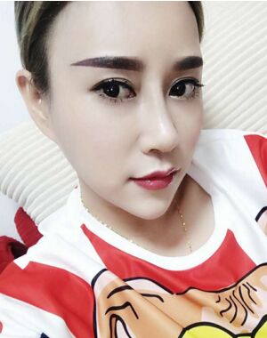 辣媽的假體豐胸整形恢復(fù)心情小日記