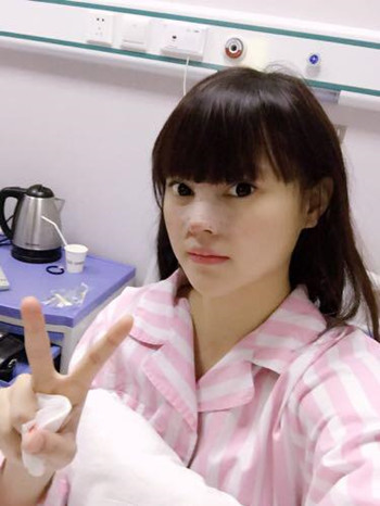 我的膨體隆鼻恢復(fù)的那些日子 內(nèi)有果對(duì)比圖