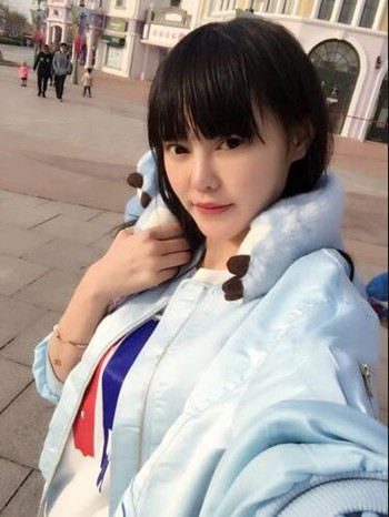 我的膨體隆鼻恢復(fù)的那些日子 內(nèi)有果對(duì)比圖