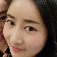 自體脂肪填充太陽穴豐額頭親身經(jīng)歷，多過程恢復(fù)圖分享