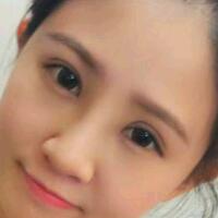 在昆明做了眼睛和鼻子整形，雖然花費(fèi)了16000元，但人美了就值！