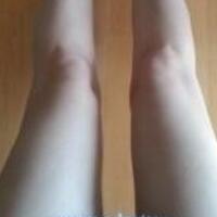 水動(dòng)力吸脂減肥瘦大腿真實(shí)經(jīng)歷，抽脂后對(duì)比照片分享