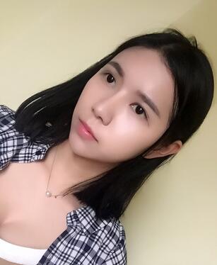 自體脂肪填充恢復(fù)日志 自體脂肪填充太陽穴+額頭