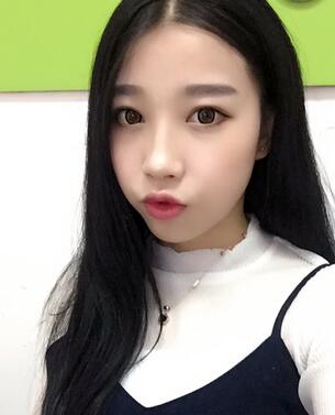 全割雙眼皮恢復(fù)日記 全切雙眼皮+開眼角