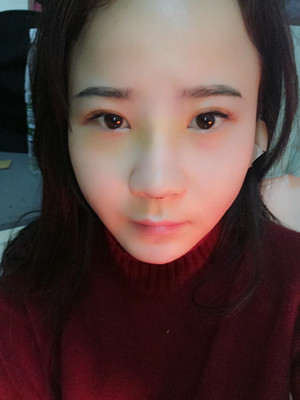 隆鼻整形前后對比變化真的不要太大哦