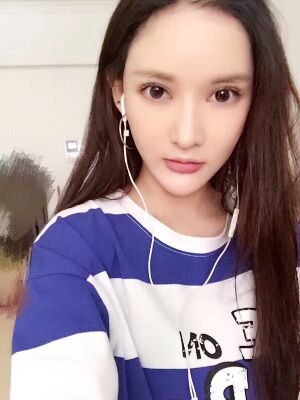 面部埋埋蛋白線.提升術(shù)后照片，皮膚緊致不少了