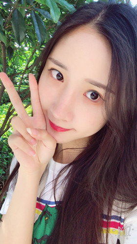 56000元做的自體脂肪填充蘋果肌+太陽穴，大家來看看果怎么樣