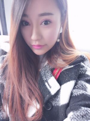 雙眼皮失敗修復(fù)手術(shù)恢復(fù)前后對比圖