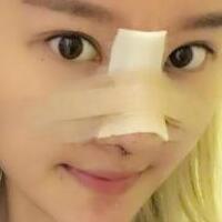 硅膠假體隆鼻過(guò)程和隆鼻前后圖片，真實(shí)案例分享