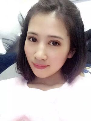 切開雙眼皮恢復(fù)過程，手術(shù)很成功哦