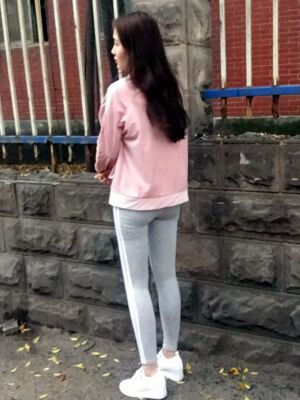 大腿吸脂果超好，腿型好看很多了