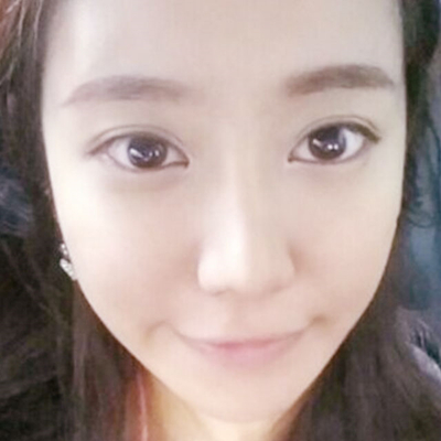 攀枝花奇麗陳光利注射瘦臉+玻尿酸隆鼻案例