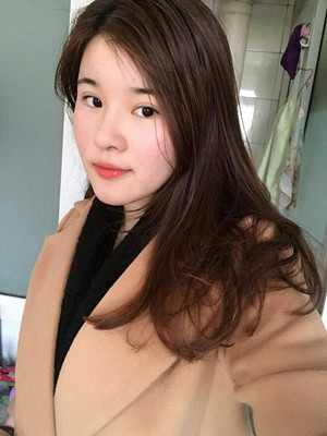 做了詳細(xì)部脂肪填充+雙眼皮+假體隆鼻，來看看果如何