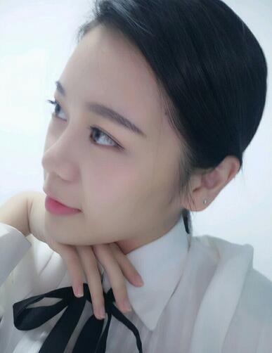 隆鼻拆線后鼻子圖片 硅膠隆鼻+鼻翼縮小恢復(fù)經(jīng)歷