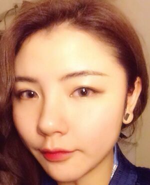 韓式定點雙眼皮前后對比圖，雙眼有神多了