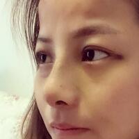 鼻部整形案例和隆鼻前后照片分享