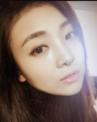 鼻子整形過程恢復(fù)圖片，真實案例分享