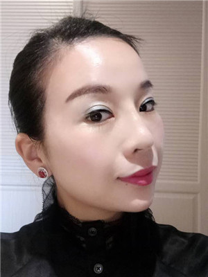 你們來看看我的面部埋埋蛋白線.提升術(shù)恢復(fù)情況