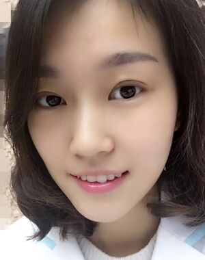 韓式微創(chuàng)雙眼皮恢復(fù)圖，超自然微創(chuàng)跡