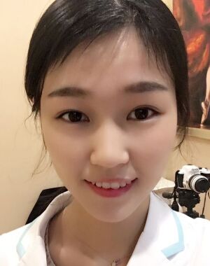 韓式微創(chuàng)雙眼皮恢復(fù)圖，超自然微創(chuàng)跡