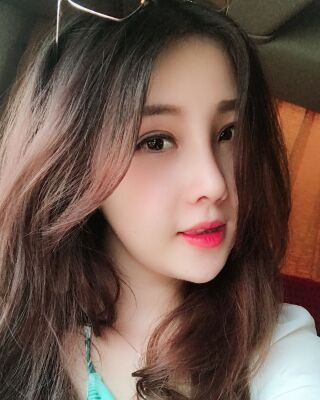 全切雙眼皮+開(kāi)眼角前后對(duì)比照片圖