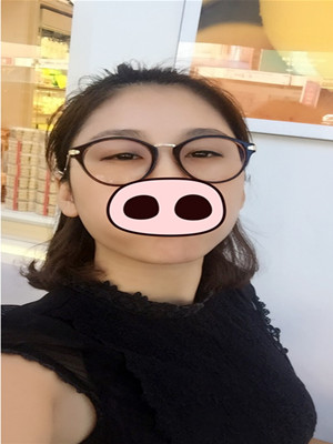 注射瘦臉去眉間紋真實(shí)案例分享——海口紅妝李科醫(yī)生做的