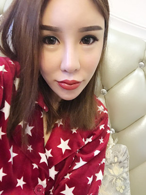 高強(qiáng)度聚焦超聲手術(shù)三個(gè)月的前后恢復(fù)記錄——?？诩t妝李科做的