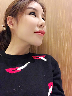 高強(qiáng)度聚焦超聲手術(shù)三個(gè)月的前后恢復(fù)記錄——海口紅妝李科做的