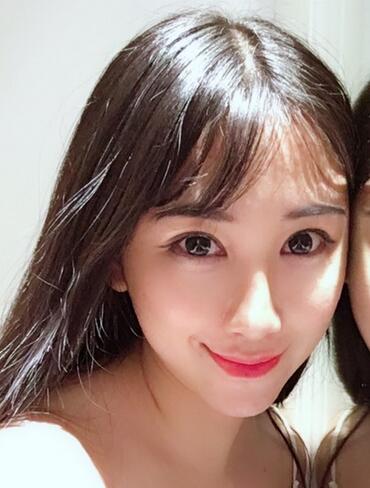 做完光子嫩膚恢復圖片 果滿滿