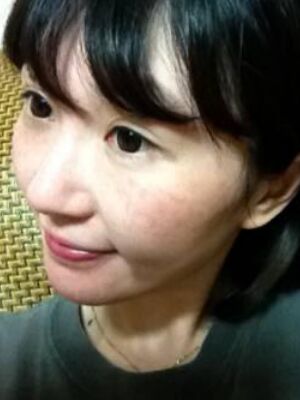 激光去雀斑果好不好，真實案例告訴你