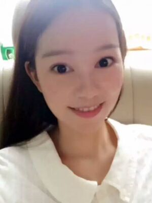 點陣激光祛痘后果對比圖，皮膚光滑多了