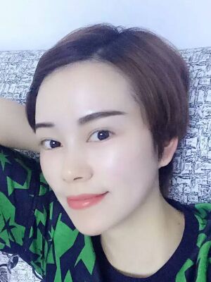 點陣激光祛痘后果對比圖，皮膚光滑多了