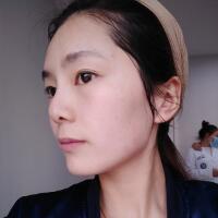 做完光子嫩膚恢復(fù)圖片和過程分享，光子嫩膚價(jià)格3800元