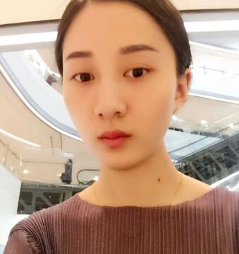 有誰(shuí)做過(guò)激光祛雀斑？個(gè)人激光祛雀斑后恢復(fù)日記分享