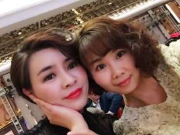 玻尿酸去法令紋后人變年輕了好幾歲